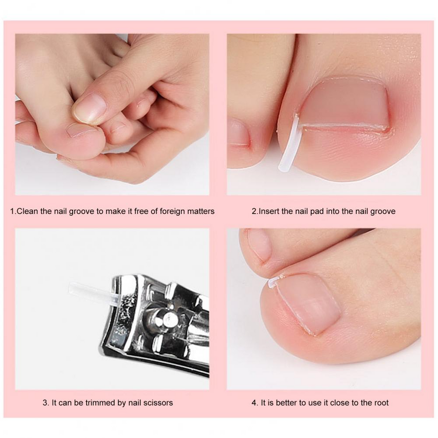 Toe Nail Support Pad - Image 2