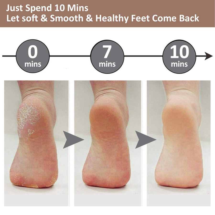 Rechargeable Foot Pedicure Machine - Image 2