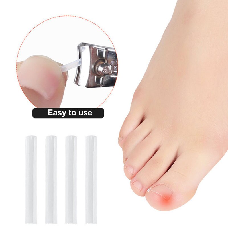 Toe Nail Support Pad - Image 1