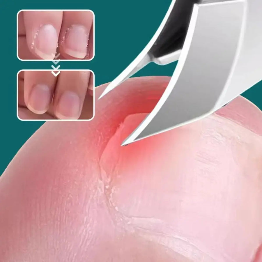 Curved Edge Sharp Ingrown Nail Clipper - Image 4