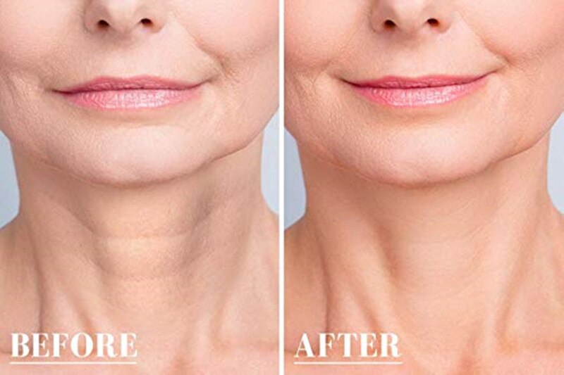 Reusable Anti Wrinkle Silicone Pads - Image 2