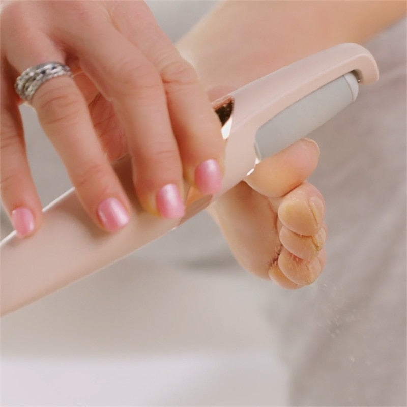 Skin Buddy Electric Dead Skin Remover - Image 0
