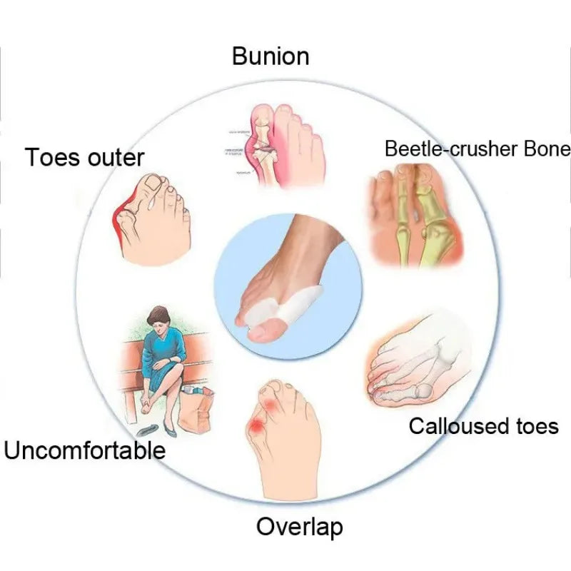Toe Separator Silicone Gel Orthopaedic Foot Corrector - Image 1