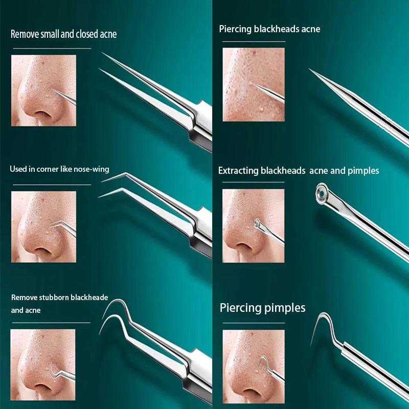 Clear Skin Blackhead Remover Care Kit - Image 4