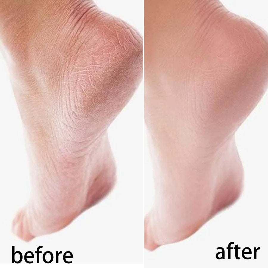 Moisturizing Reusable Hydrating Socks - Image 5