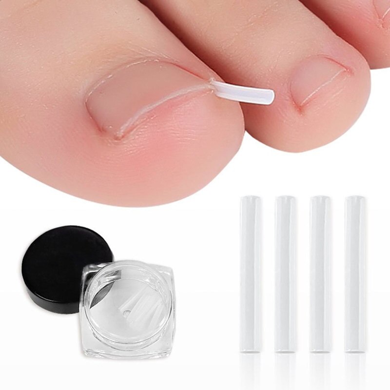 Toe Nail Support Pad: The Thoughtful Gift for Ingrown Toenail Relief
