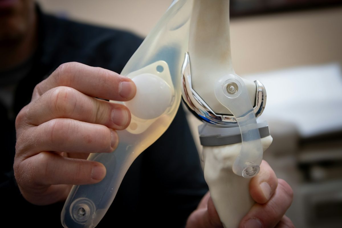 Knee Support: Your Guide to Choosing the Right One