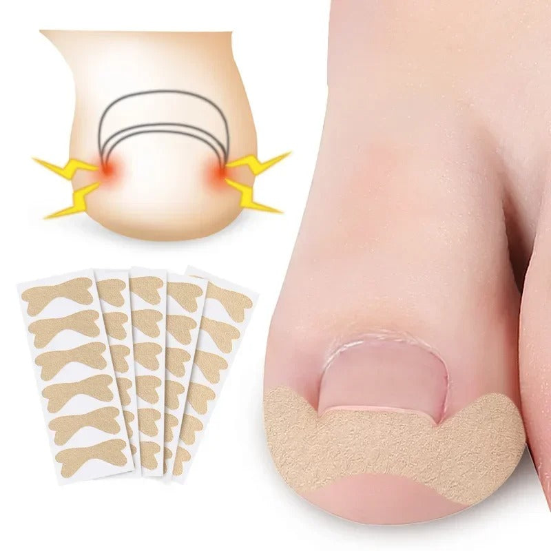 Toe Align Ingrown Nail Corrector Stickers - Image 11