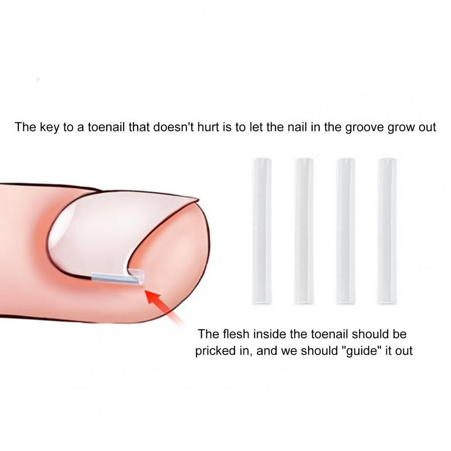 Toe Nail Support Pad - Image 4