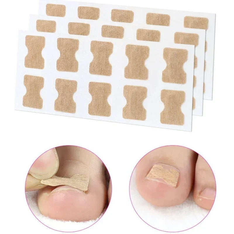 Toe Align Ingrown Nail Corrector Stickers - Image 13