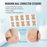 Toe Align Ingrown Nail Corrector Stickers - Image 3