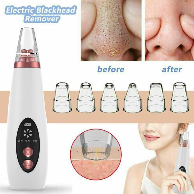 Pure Skin Rechargeable Blackhead Remover Machine