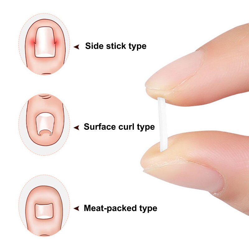 Toe Nail Support Pad - Image 3