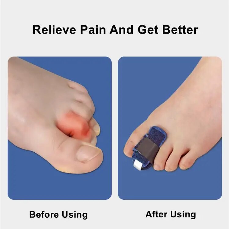 Gentle Touch Toe Corrector Stabilizer