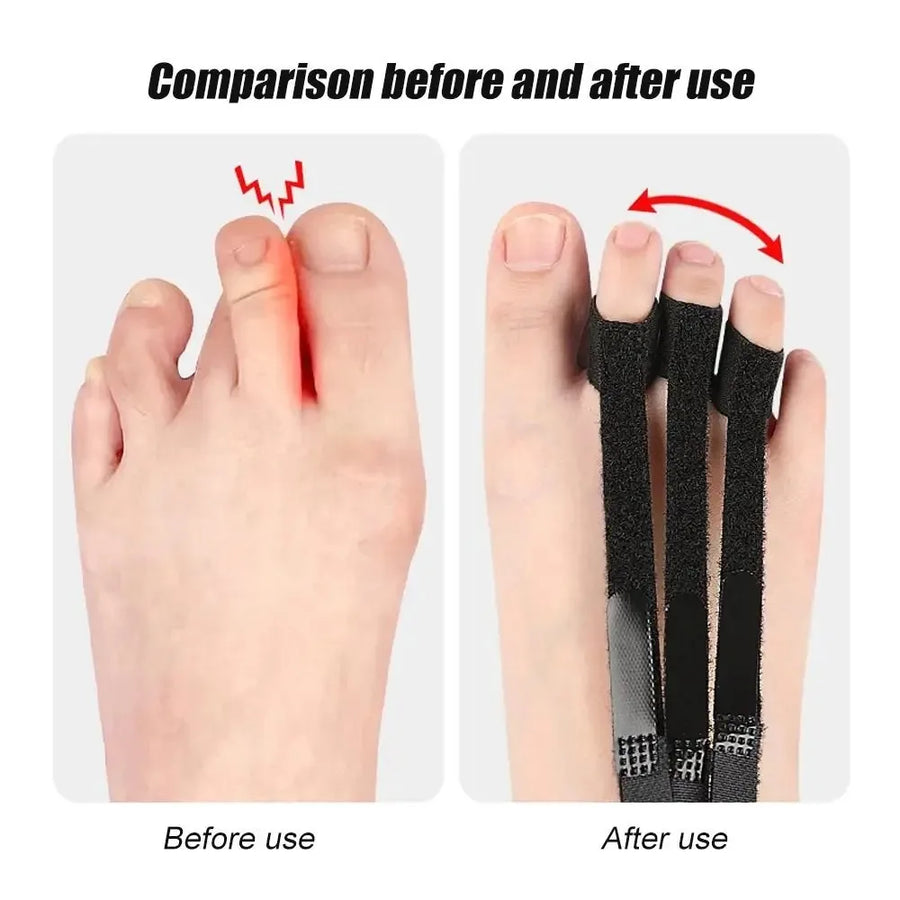 Relief Step Toe Positioning Correction Strap