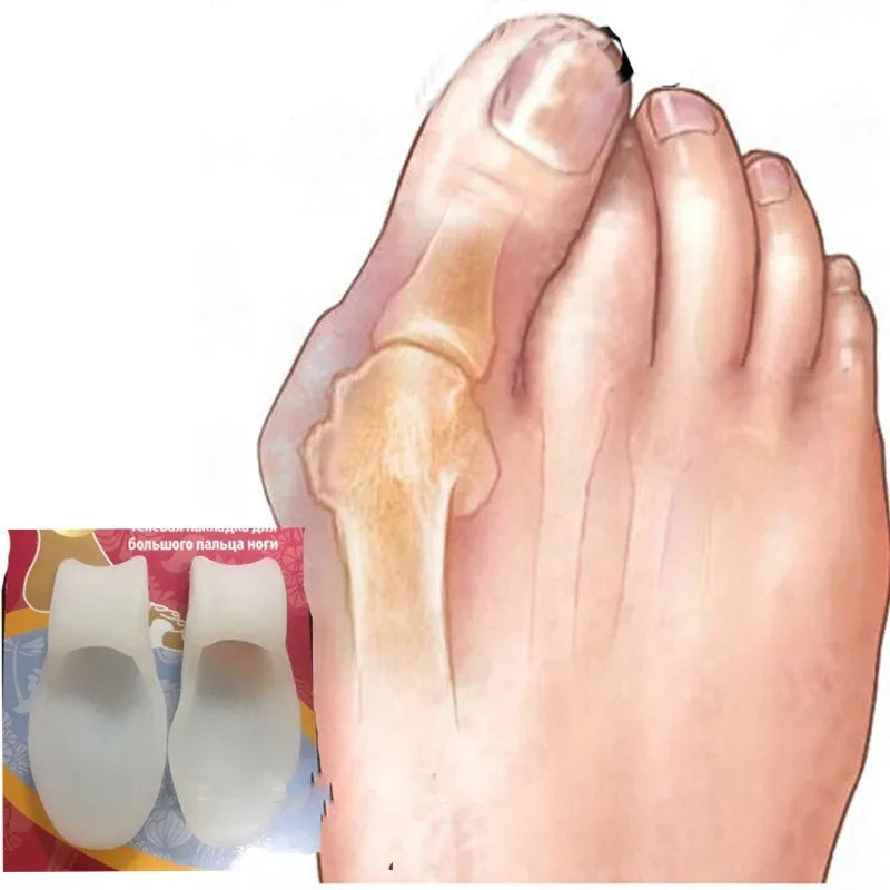 Toe Separator Silicone Gel Orthopaedic Foot Corrector - Image 4