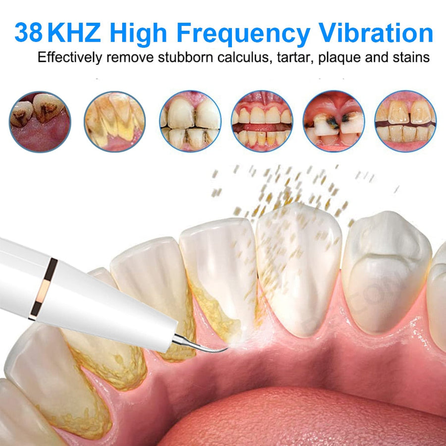 Gentle Touch Rechargeable Ultrasonic Tooth Cleaner Set - Image 1
