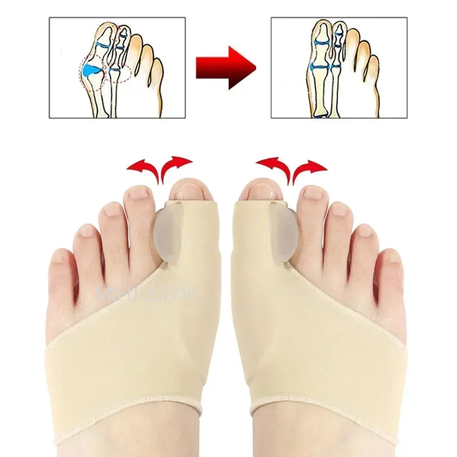 Toe Alignment Corrector Foot Support Sleeve - Image 3