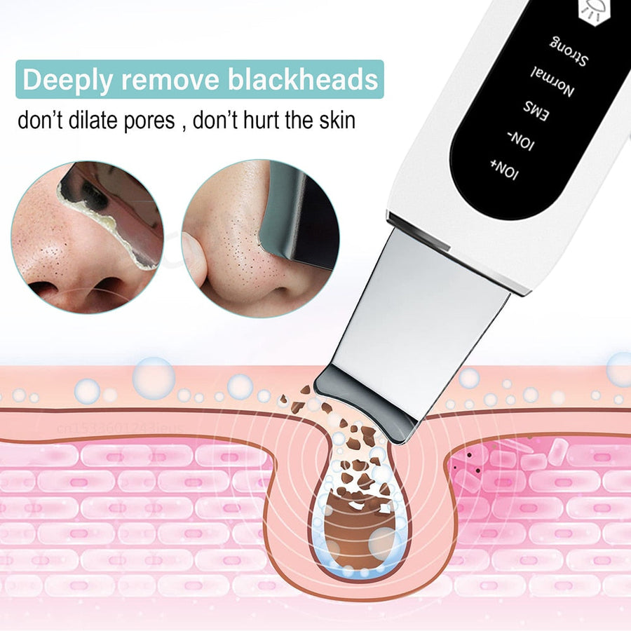 Deep Face Cleaning Ultrasonic Facial Cleanser - Image 3