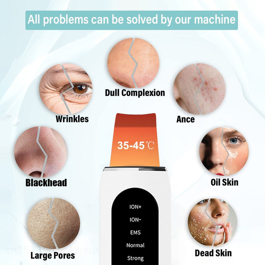 Deep Face Cleaning Ultrasonic Facial Cleanser - Image 2