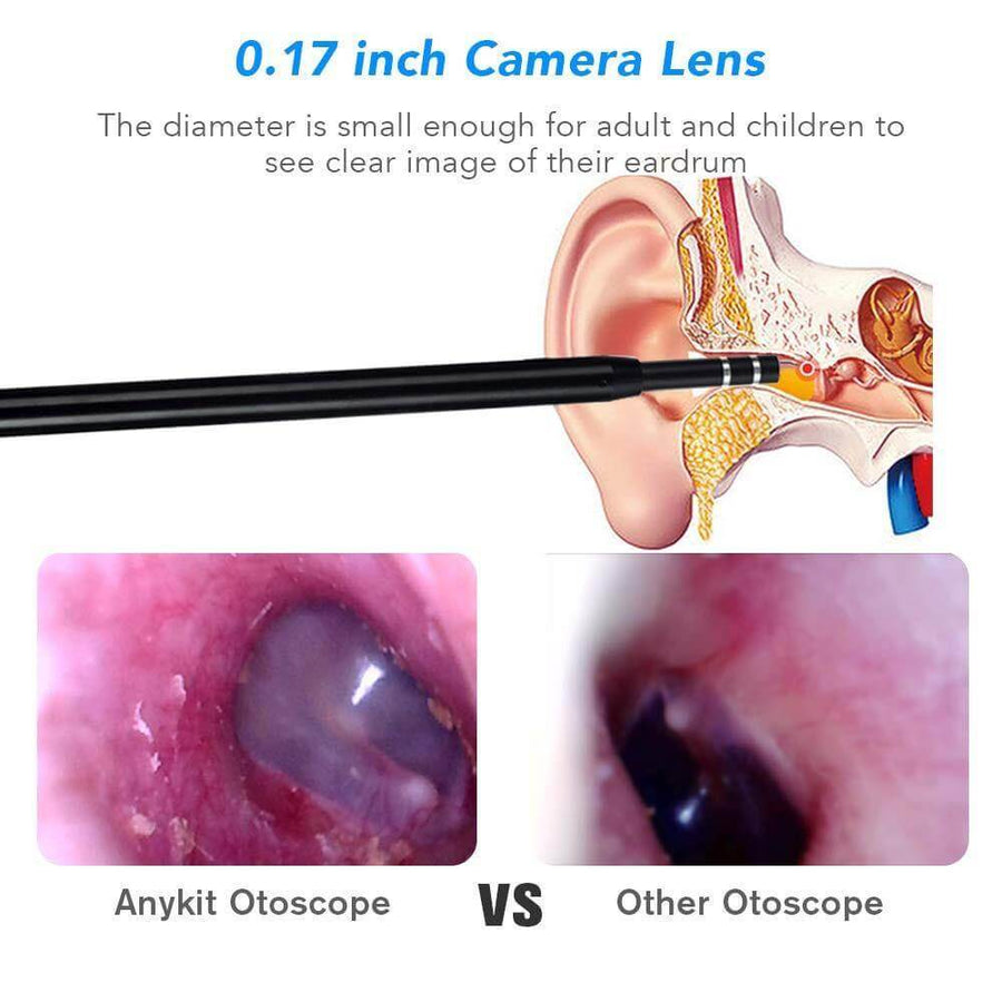 Mini Camera Visual Ear Cleaner - Image 7