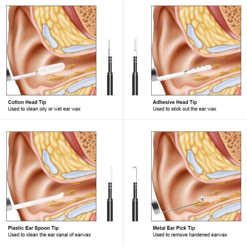 Mini Camera Visual Ear Cleaner - Image 4