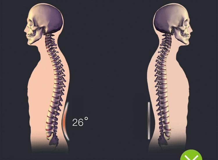 Magic Stretcher Chiropractic Back Massager - Image 3